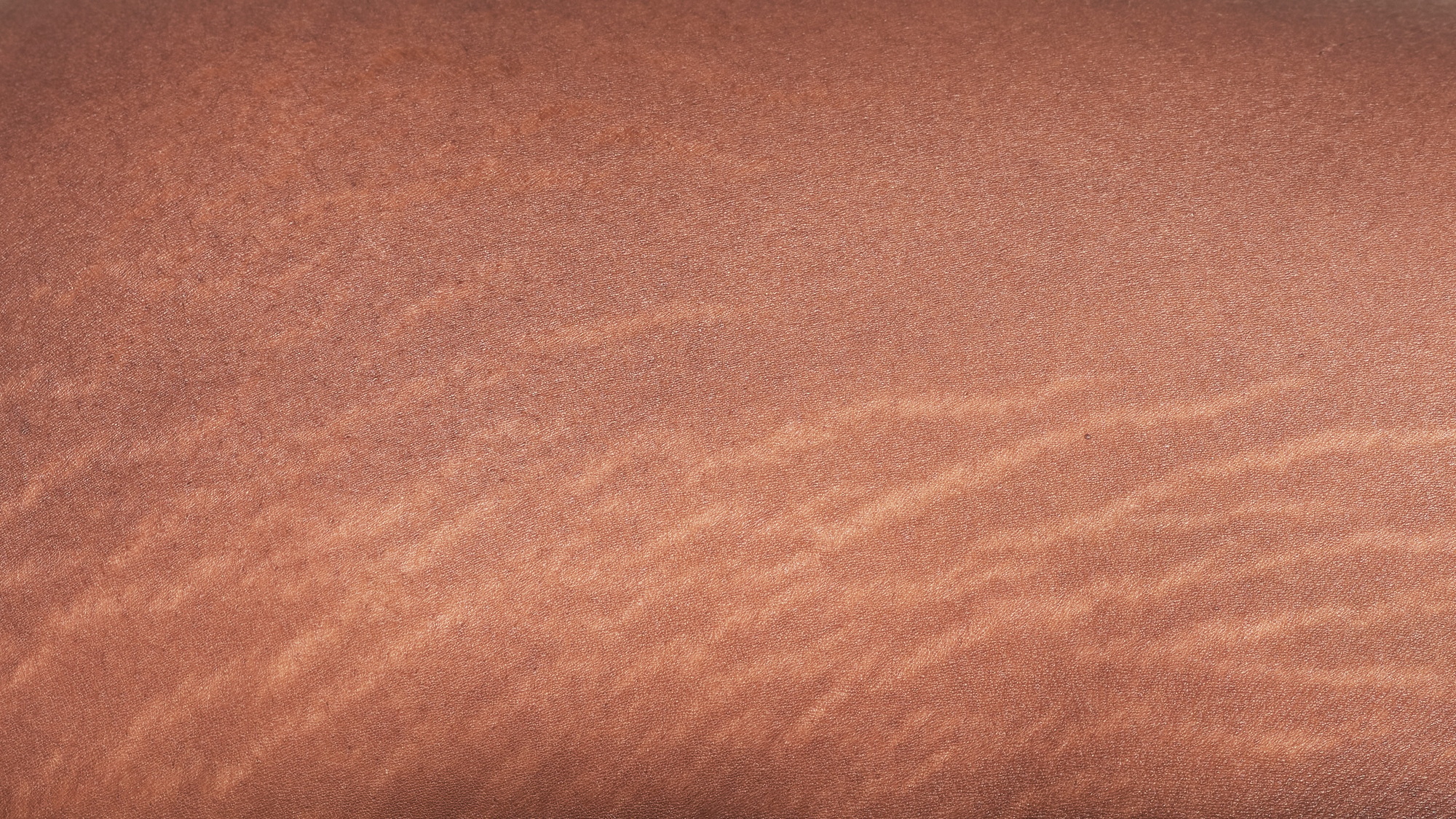 Brown skin with white freckles closeup complexion